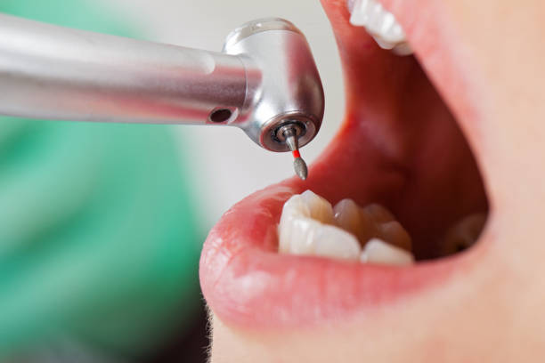 Best Emergency Denture Repair in Fort Davis, TX